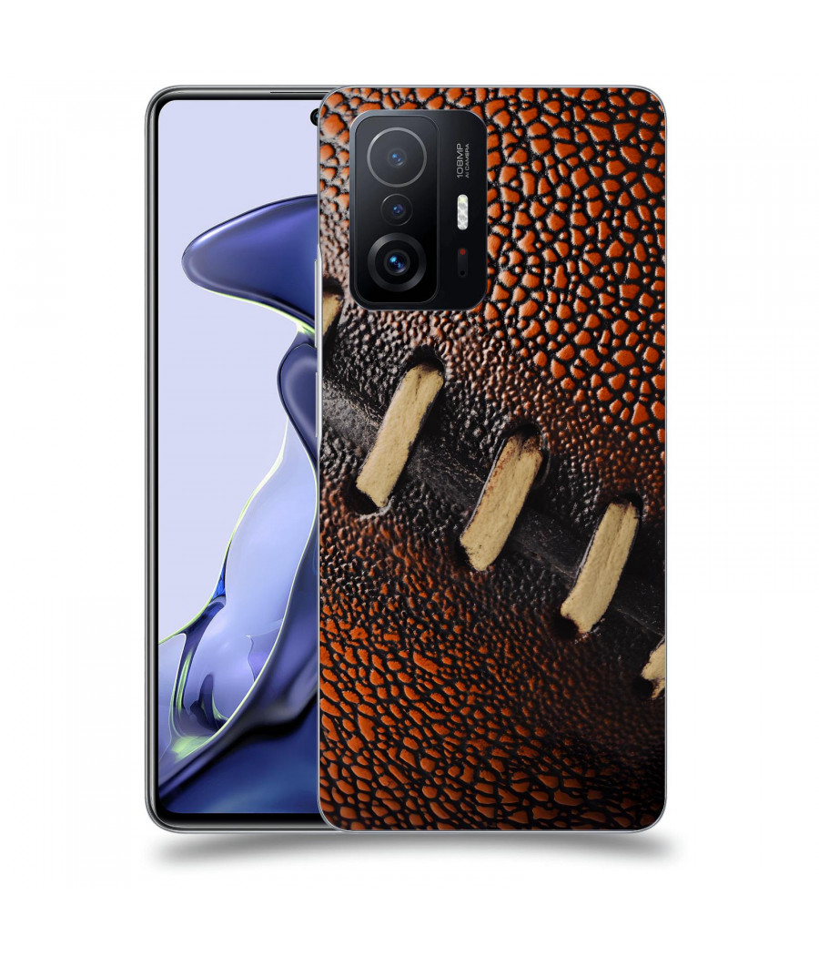 ACOVER Kryt na mobil Xiaomi...